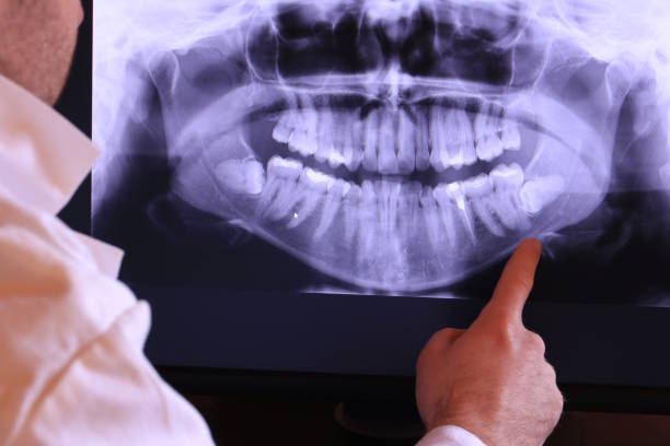Best Tooth Infection Emergency Dentist  in Ojai, CA