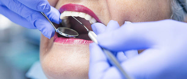 Best Chipped Tooth Repair Near Me  in Ojai, CA